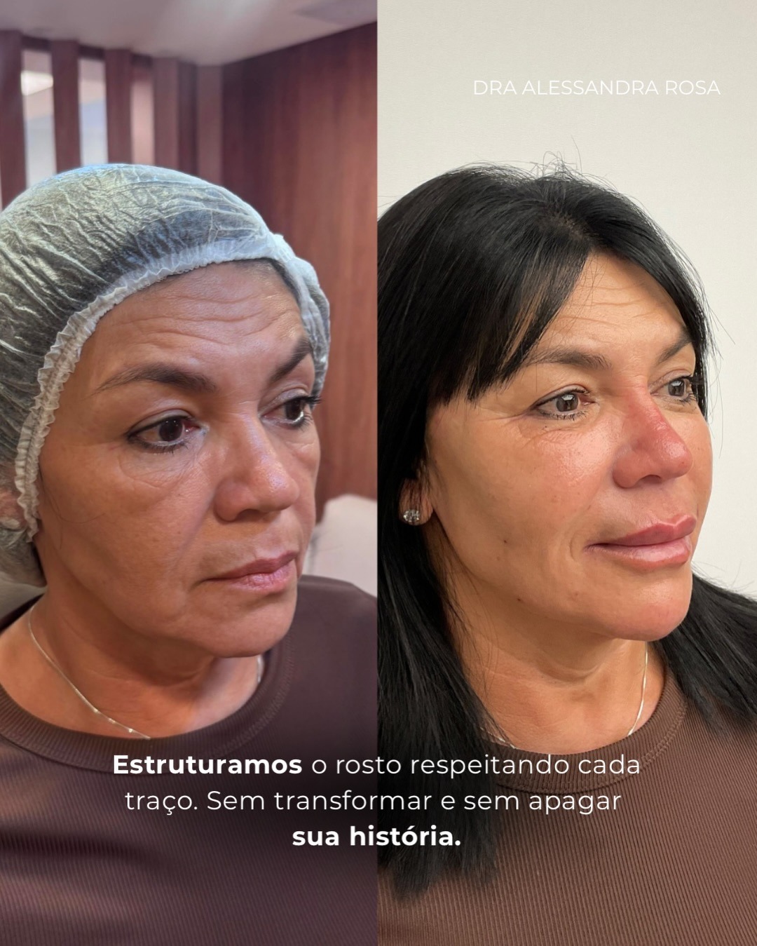 Estruturamos o rosto respeitando cada traço