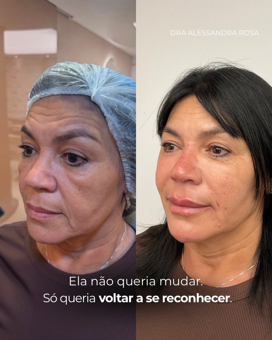 Ela não queria mudar, só voltar a se reconhecer