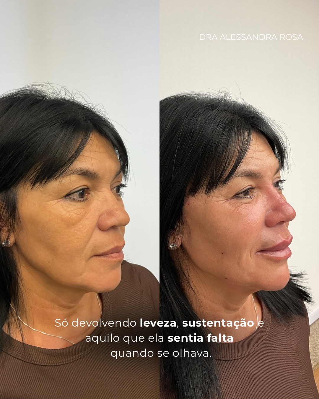 Devolvendo leveza e sustentação